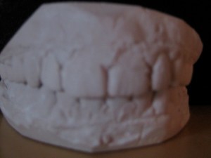My old teeth